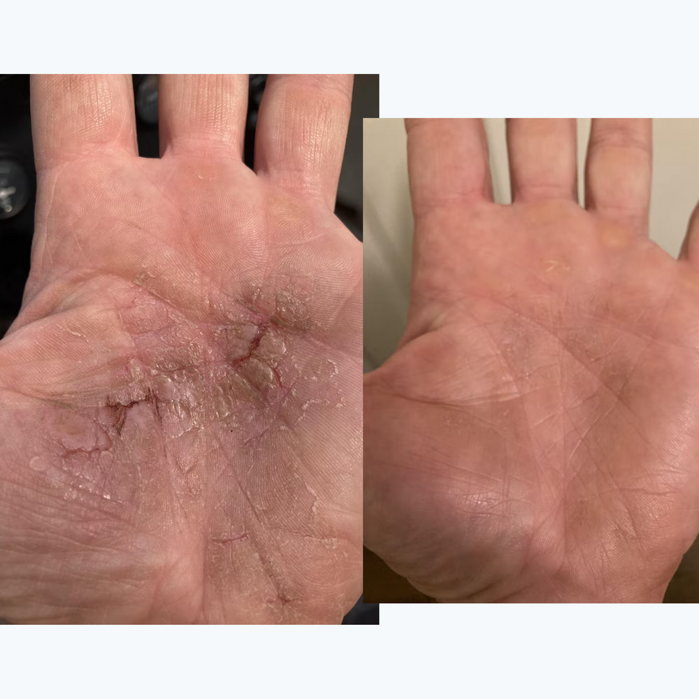 Palm of the hand before and after using Marin