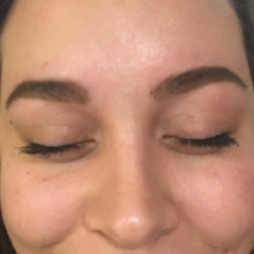 Close-up of clearer skin around the eyes after Marin